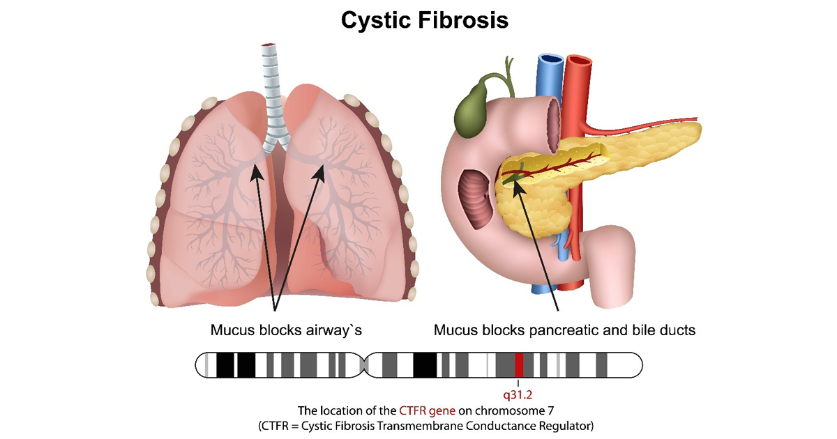 CF