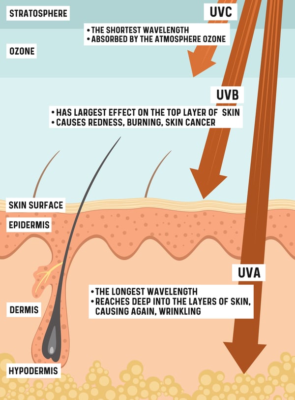 OET 2.0 sun damage diagram